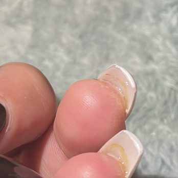 DaVi Nails - Woke up to puss and blisters around and under my nails - Nail Salons Near Me - Bakersfield, California