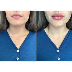 RNA Medical Aesthetics