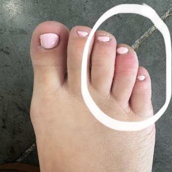 Venus Nail - Toe is red and swollen - Nail Salons Near Me - Baton Rouge, Louisiana Venus Nail - Toe is red and swollen - Nail Salons Near Me - Baton Rouge, Louisiana