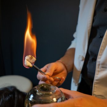 Timmy Tran Acupuncture - Fire cupping to promote blood circulation and relief of muscle tension - Acupuncture Near Me - San Francisco, California Timmy Tran Acupuncture - Fire cupping to promote blood circulation and relief of muscle tension - Acupuncture Near Me - San Francisco, California