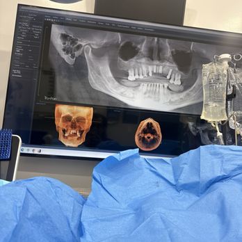 Bionic Smile - Day 1 - Cosmetic Dentists Near Me - Las Vegas, Nevada