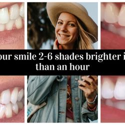 Shine Bright Beauty & Body - 2-6 shades brighter, no sensitivity