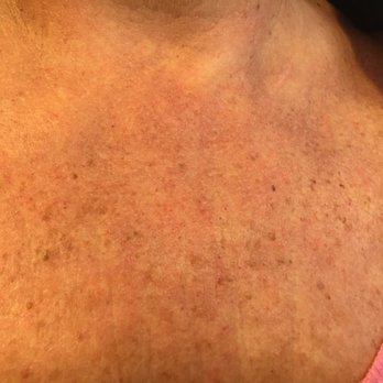 Landa MedSpa - Skin Care Near Me - Framingham, Massachusetts Landa MedSpa - Skin Care Near Me - Framingham, Massachusetts