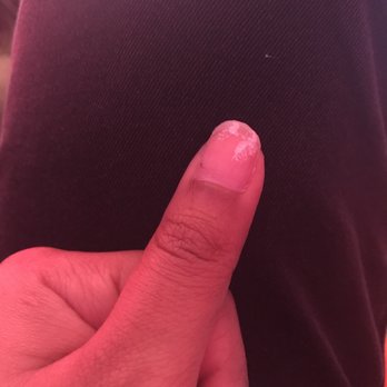 Ideal Nails - broken nail - Nail Salons Near Me - New York, New York