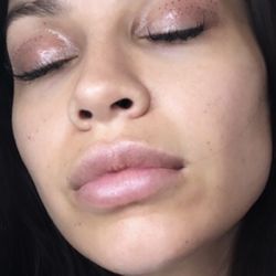 Rejuvenation/ClubSkinGym - Fibroblast Skin Tightening