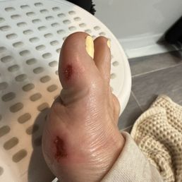 Still healing Still healing
