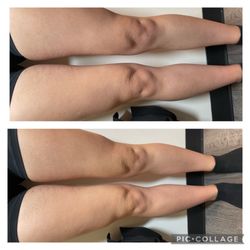 Curves And Aesthetics By Maritsa - Before and after photo. left is before and after is on the right.
