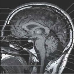 Brain Center of Hudson Valley