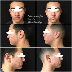 All About Me Laser Medspa