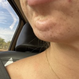 Sausage chin ‍
