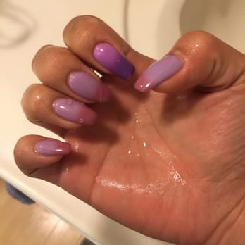 Worldgate Nails - And here's how it turns to a different color. That one nail just stands out and makes me feel so bad. - Nail Salons Near Me - Herndon, Virginia Worldgate Nails - And here's how it turns to a different color. That one nail just stands out and makes me feel so bad. - Nail Salons Near Me - Herndon, Virginia