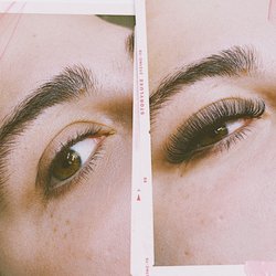 April May Esthetics - Volume before and after