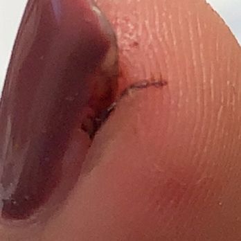 Envy Nails And Spa - Nail Tech split my skin in half after scraping off my previous gel color. Continually bled till I left - Nail Salons Near Me - Melbourne, Florida Envy Nails And Spa - Nail Tech split my skin in half after scraping off my previous gel color. Continually bled till I left - Nail Salons Near Me - Melbourne, Florida
