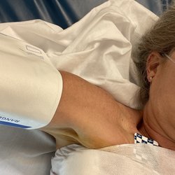 Encore Rehabilitation - Chest tube sticking out of me while in the ICU