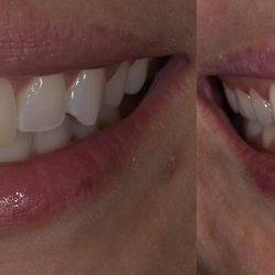 Twin Falls Family Dentistry