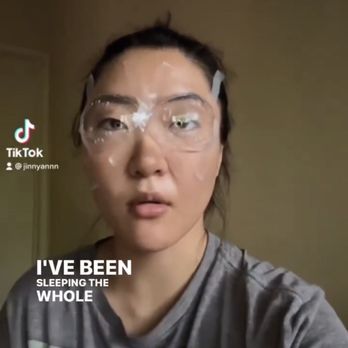 Laser Eye Center - After icl - Optometrists Near Me - Los Angeles, California
