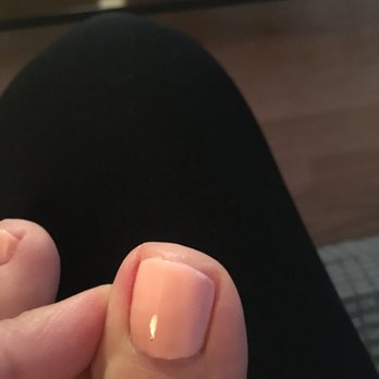 Sonia Salon - Left toe that was cut way too short. Sonia said "well people have different tastes" - Waxing Near Me - Chicago, Illinois Sonia Salon - Left toe that was cut way too short. Sonia said "well people have different tastes" - Waxing Near Me - Chicago, Illinois