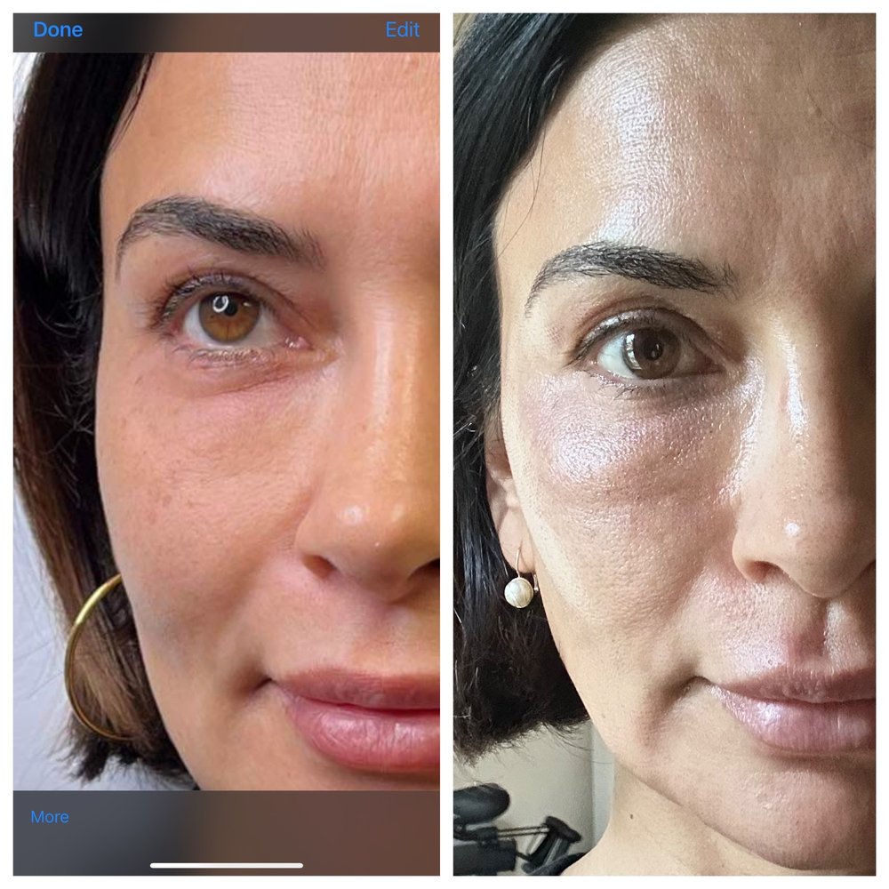 REJUVE SPA BODY CONTOURING 19 Photos 7107 FM 2920, Spring, Texas