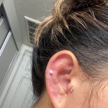 Mastodon Professional Body Piercing - Before - Piercing Near Me - Scottsdale, Arizona Mastodon Professional Body Piercing - Before - Piercing Near Me - Scottsdale, Arizona