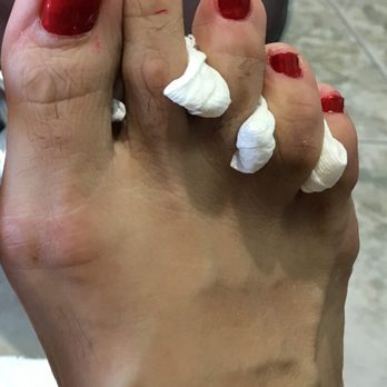 D & L Nails Spa - Look at the middle toe, this too is after she cleaned the excess polish. - Nail Salons Near Me - Freedom, California