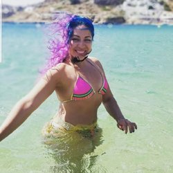Tehrani Plastic Surgery - Before augmentation pic