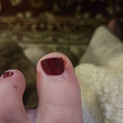Yamada Nail Atelier - Open cut on upper right corner of my large toe from the cuticle cutters