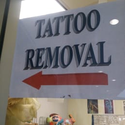 Getting rid of gang related tattoos