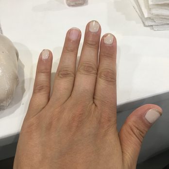 Modern Spa - 1 week after gel French manicure - chipped and peeling. - Nail Salons Near Me - New York, New York Modern Spa - 1 week after gel French manicure - chipped and peeling. - Nail Salons Near Me - New York, New York