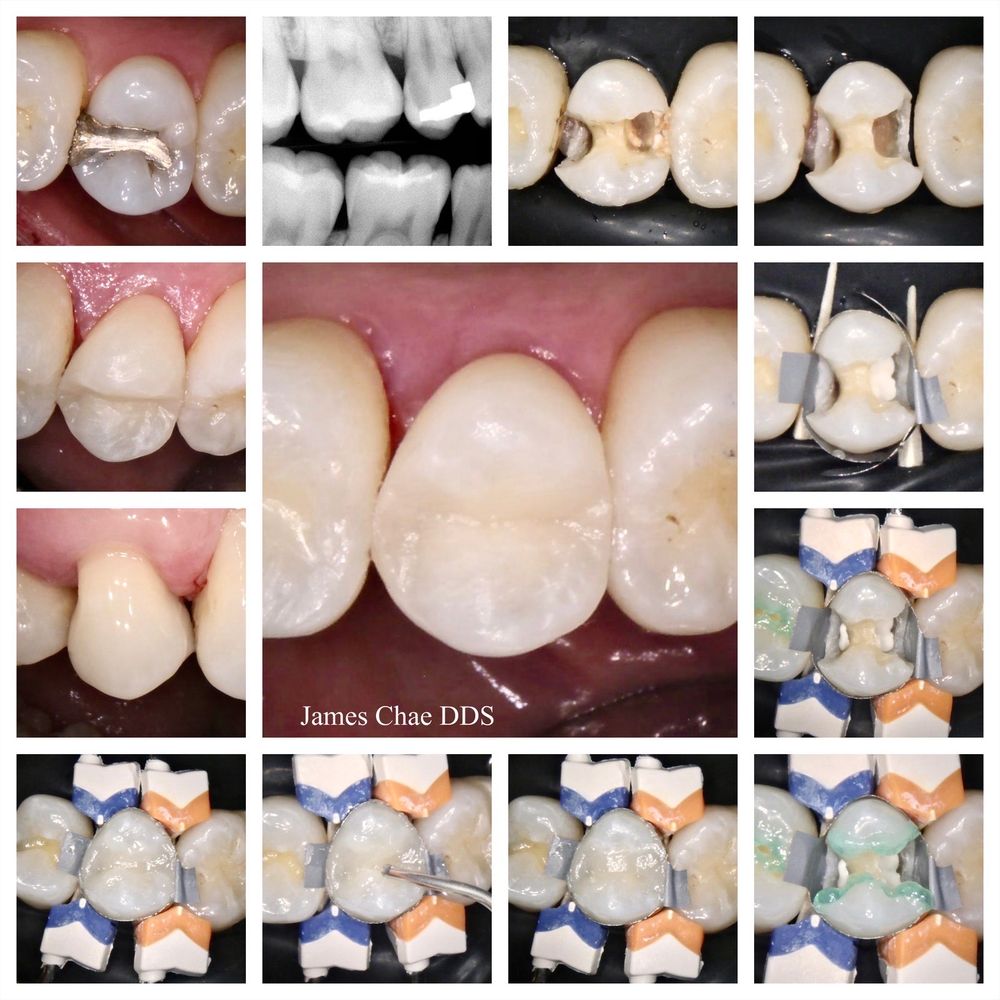 Top 10 Best Dentists near Diamond Bar, CA Last Updated August 2021 Yelp