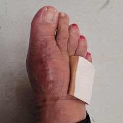 Maverick Foot and Ankle Specialists - She fixed the toenail too!!!!! Dr Larissa rocks!!!  WHAT ARE YOU WAITING ON.....MAKE YOUR APPOINTMENT!!!