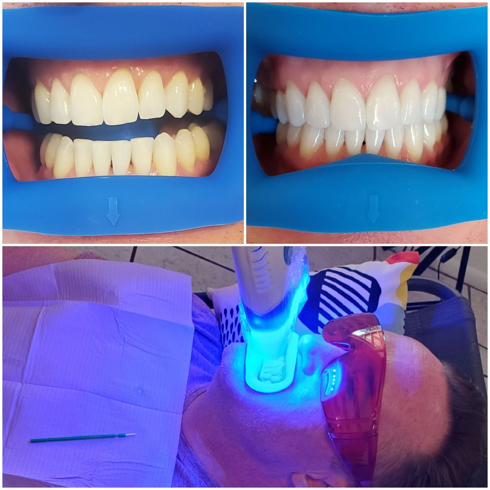 White Smiles & Tooth Gems Logo