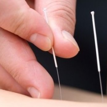 Holy Acupuncture - Acupuncture Near Me - Gaithersburg, Maryland Holy Acupuncture - Acupuncture Near Me - Gaithersburg, Maryland