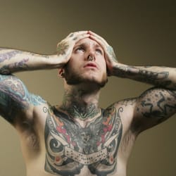 No Regrets Laser Services - Tattoo Removal by a Nurse