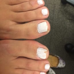 Not even 24 hours later! No I didn't get in a pool, or pick at them... I got home from work and took my shoes off! Not even 24 hours later! No I didn't get in a pool, or pick at them... I got home from work and took my shoes off!