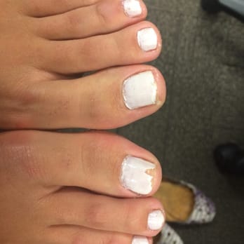 Abatte peluqueria - Not even 24 hours later! No I didn't get in a pool, or pick at them... I got home from work and took my shoes off! - Hair Salons Near Me - Miami, Florida Abatte peluqueria - Not even 24 hours later! No I didn't get in a pool, or pick at them... I got home from work and took my shoes off! - Hair Salons Near Me - Miami, Florida