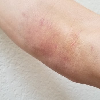 Quest Diagnostics - 3 days after - Laboratory Testing Near Me - Torrance, California