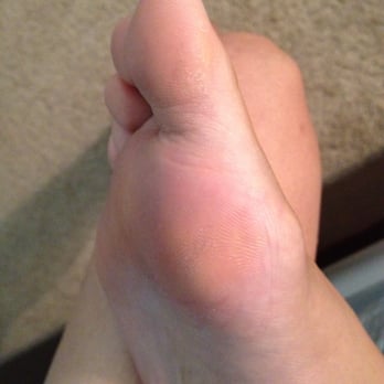 Nails Star - Calluses were not removed. - Nail Salons Near Me - Plano, Texas Nails Star - Calluses were not removed. - Nail Salons Near Me - Plano, Texas
