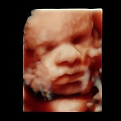 Ultrasound Express