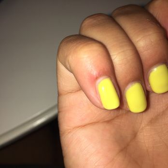 NiNi Nails Salon - Pinky finger red and inflamed - Nail Salons Near Me - Tampa, Florida NiNi Nails Salon - Pinky finger red and inflamed - Nail Salons Near Me - Tampa, Florida