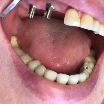 Haris Hashimi - Implants - General Dentistry Near Me - Riverside, California Haris Hashimi - Implants - General Dentistry Near Me - Riverside, California
