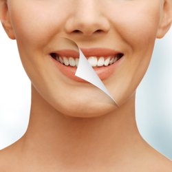 Silver Spring Cosmetic Dentistry - Transforming Smiles Everyday!