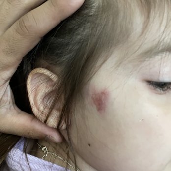 Little Lambs Learning Academy - Also not to mention that his is. ow a scar! - Child Care & Day Care Near Me - Killeen, Texas Little Lambs Learning Academy - Also not to mention that his is. ow a scar! - Child Care & Day Care Near Me - Killeen, Texas