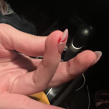 Get Nailed Salon - Cut her finger. - Nail Salons Near Me - Roseville, California