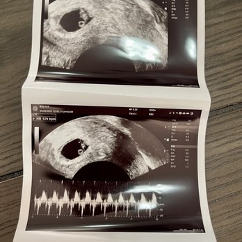 Bay IVF - Fertility Near Me - Palo Alto, California