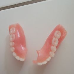 Yuba City Affordable Dentures - Broken denture