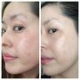 Photo of Advanced Skin & Laser Clinic
