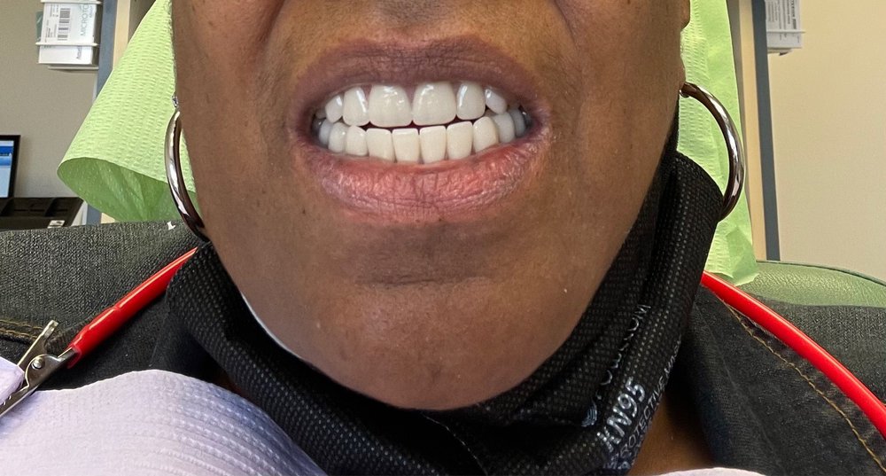 DENTAL ONE ASSOCIATES OF OXON HILL Updated October 2024 16 Reviews