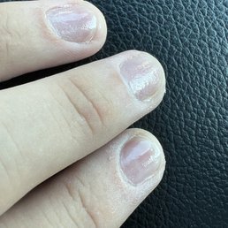 Very deep scratches from rotary tool. Very deep scratches from rotary tool.
