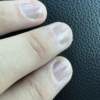 Nails-A-Holic - Very deep scratches from rotary tool. - Nail Salons Near Me - North Olmsted, Ohio Nails-A-Holic - Very deep scratches from rotary tool. - Nail Salons Near Me - North Olmsted, Ohio
