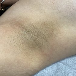 Novelty Beauty - Underarm Sugaring